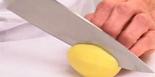 Kartoffeln schälen und schneiden